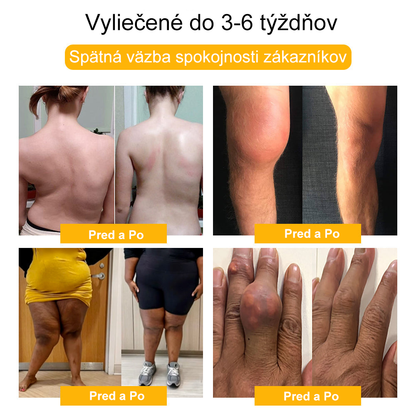 𝐀𝐫𝐭𝐡𝐫𝐨𝐅𝐫𝐞𝐞™  Včelí jed proti bolesti kĺbov a regeneračný krém🐝 (odporúčaný najmä pre starších ľudí a odporúčaný Ministerstvom zdravotníctva Slovenskej republiky - MZSR) 🍀